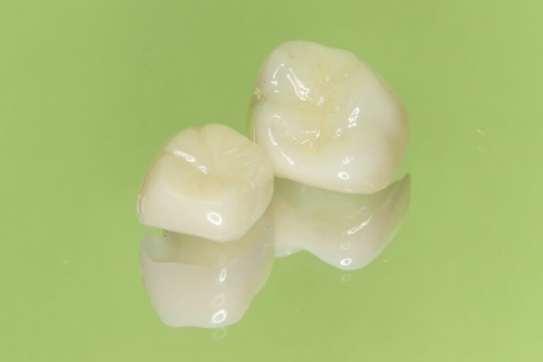 銀歯を白くする【CAD/CAM冠】の保険適用は奥歯にも対応！2024年（6月改定） - 九品仏の歯医者（歯科)｜ハッピーデンタルクリニック