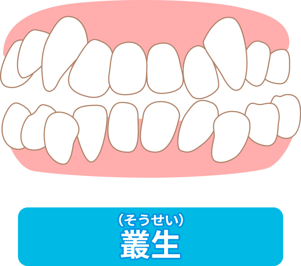 叢生