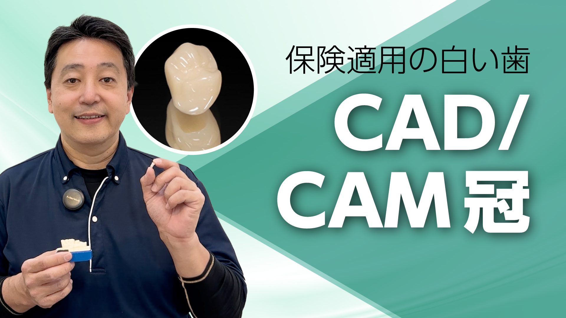 CAD/CAM冠（保険適用の白い歯） - 九品仏・奥沢・自由が丘の歯医者